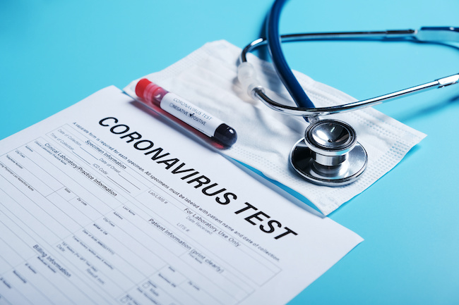 Local Health body urges the public to use the correct routes to book a coronavirus test Image By Have a nice day AdobeStock_318621937